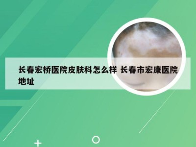 长春宏桥医院皮肤科怎么样 长春市宏康医院地址