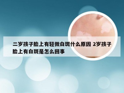 二岁孩子脸上有轻微白斑什么原因 2岁孩子脸上有白斑是怎么回事