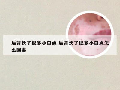 后背长了很多小白点 后背长了很多小白点怎么回事