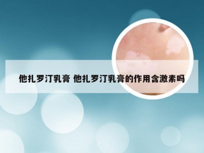 他扎罗汀乳膏 他扎罗汀乳膏的作用含激素吗