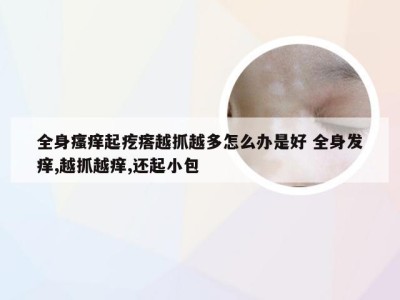 全身瘙痒起疙瘩越抓越多怎么办是好 全身发痒,越抓越痒,还起小包