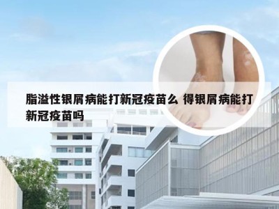 脂溢性银屑病能打新冠疫苗么 得银屑病能打新冠疫苗吗