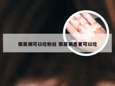 银屑病可以吃粉丝 银屑病患者可以吃