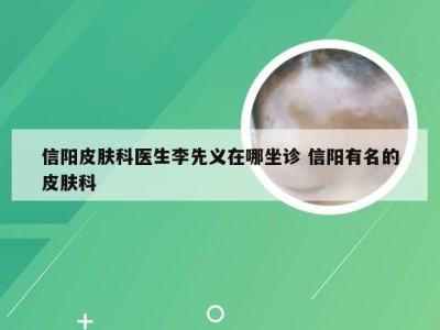 信阳皮肤科医生李先义在哪坐诊 信阳有名的皮肤科