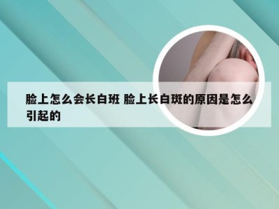 脸上怎么会长白班 脸上长白斑的原因是怎么引起的