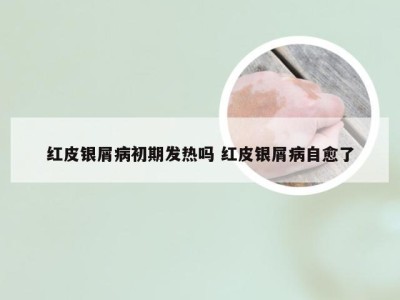 红皮银屑病初期发热吗 红皮银屑病自愈了