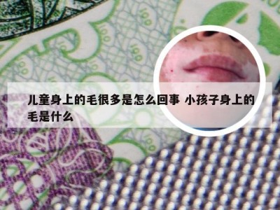 儿童身上的毛很多是怎么回事 小孩子身上的毛是什么