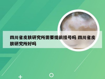 四川省皮肤研究所需要提前挂号吗 四川省皮肤研究所好吗