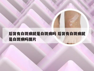 后背有白斑病就是白斑病吗 后背有白斑病就是白斑病吗图片