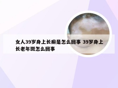 女人39岁身上长癣是怎么回事 39岁身上长老年斑怎么回事