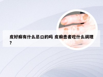 皮好癣有什么忌口的吗 皮癣患者吃什么调理?