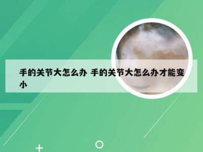 手的关节大怎么办 手的关节大怎么办才能变小