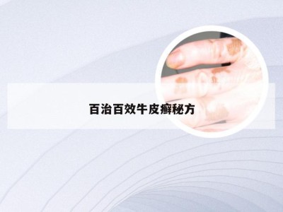 百治百效牛皮癣秘方