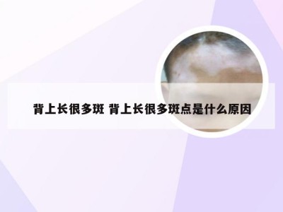 背上长很多斑 背上长很多斑点是什么原因