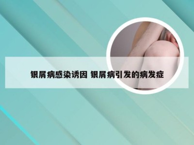 银屑病感染诱因 银屑病引发的病发症