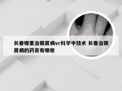 长春哪里治银屑病vr科学中技术 长春治银屑病的药膏有哪些