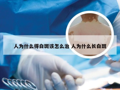 人为什么得白斑该怎么治 人为什么长白斑