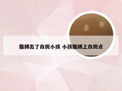 胳膊出了白斑小孩 小孩胳膊上白斑点