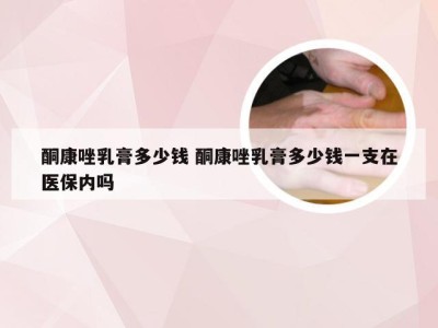 酮康唑乳膏多少钱 酮康唑乳膏多少钱一支在医保内吗