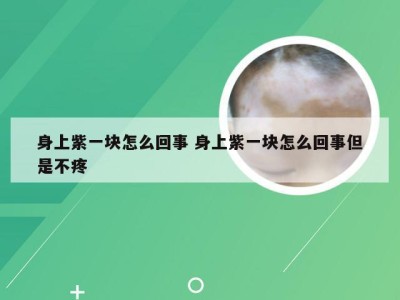 身上紫一块怎么回事 身上紫一块怎么回事但是不疼