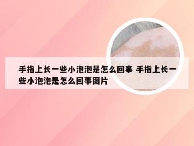 手指上长一些小泡泡是怎么回事 手指上长一些小泡泡是怎么回事图片