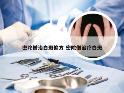 密陀僧治白斑偏方 密陀僧治疗白斑