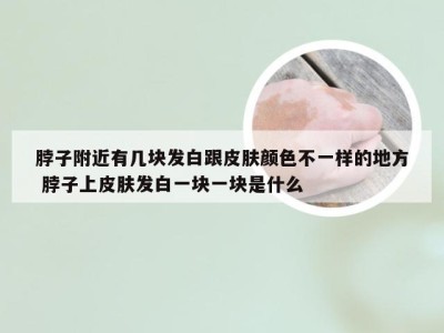 脖子附近有几块发白跟皮肤颜色不一样的地方 脖子上皮肤发白一块一块是什么