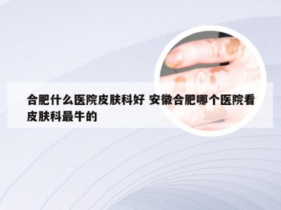 合肥什么医院皮肤科好 安徽合肥哪个医院看皮肤科最牛的