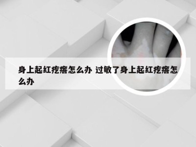 身上起红疙瘩怎么办 过敏了身上起红疙瘩怎么办