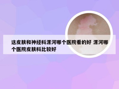 这皮肤和神经科漯河哪个医院看的好 漯河哪个医院皮肤科比较好