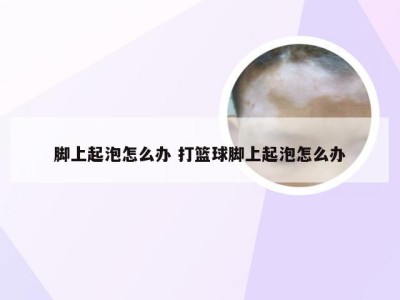 脚上起泡怎么办 打篮球脚上起泡怎么办