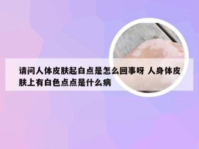 请问人体皮肤起白点是怎么回事呀 人身体皮肤上有白色点点是什么病