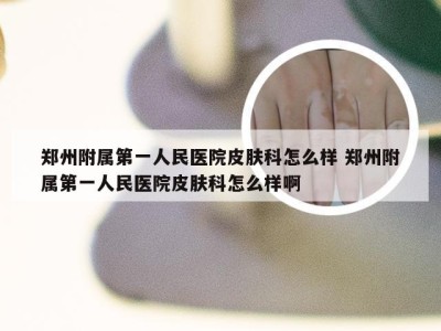 郑州附属第一人民医院皮肤科怎么样 郑州附属第一人民医院皮肤科怎么样啊