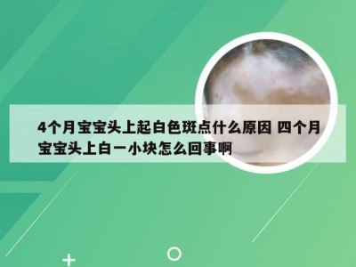 4个月宝宝头上起白色斑点什么原因 四个月宝宝头上白一小块怎么回事啊