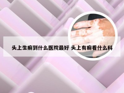 头上生癣到什么医院最好 头上有癣看什么科