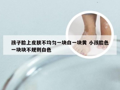 孩子脸上皮肤不均匀一块白一块黄 小孩脸色一块块不规则白色