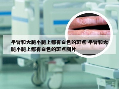 手臂和大腿小腿上都有白色的斑点 手臂和大腿小腿上都有白色的斑点图片