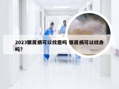 2023银屑病可以纹眉吗 银屑病可以纹身吗?