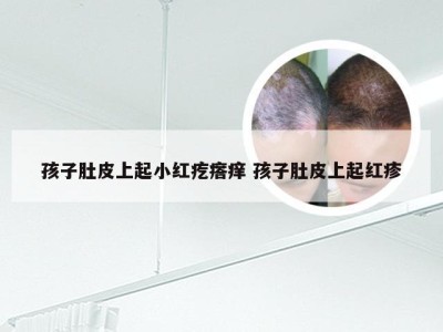 孩子肚皮上起小红疙瘩痒 孩子肚皮上起红疹