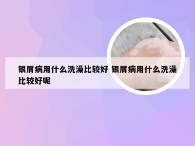 银屑病用什么洗澡比较好 银屑病用什么洗澡比较好呢