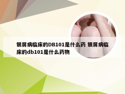 银屑病临床的DB101是什么药 银屑病临床的db101是什么药物