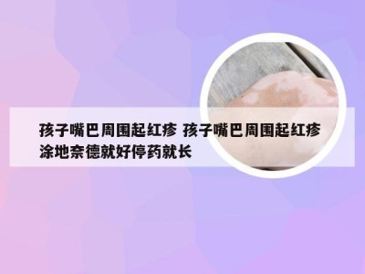 孩子嘴巴周围起红疹 孩子嘴巴周围起红疹 涂地奈德就好停药就长