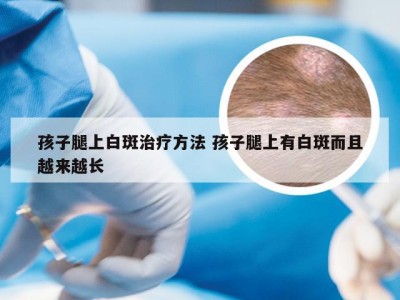 孩子腿上白斑治疗方法 孩子腿上有白斑而且越来越长