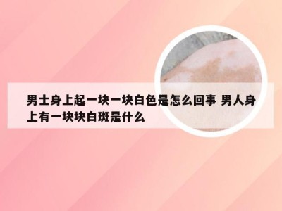 男士身上起一块一块白色是怎么回事 男人身上有一块块白斑是什么