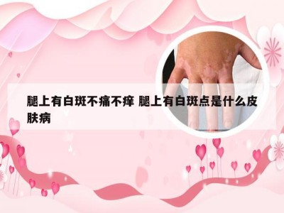 腿上有白斑不痛不痒 腿上有白斑点是什么皮肤病