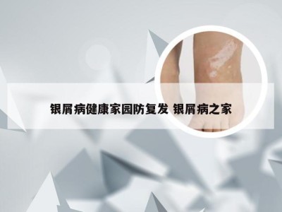 银屑病健康家园防复发 银屑病之家