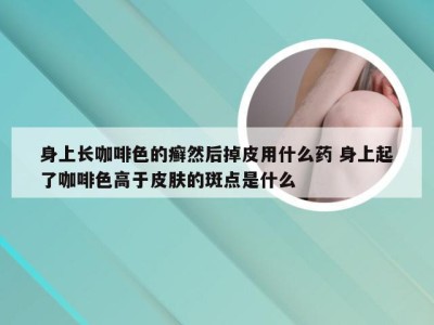 身上长咖啡色的癣然后掉皮用什么药 身上起了咖啡色高于皮肤的斑点是什么