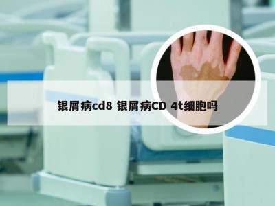 银屑病cd8 银屑病CD 4t细胞吗