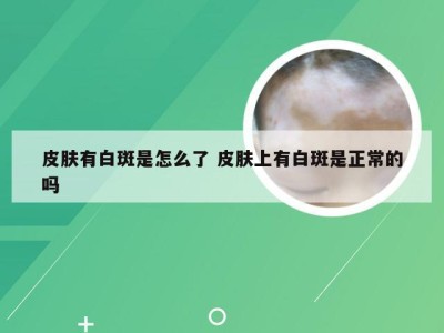 皮肤有白斑是怎么了 皮肤上有白斑是正常的吗