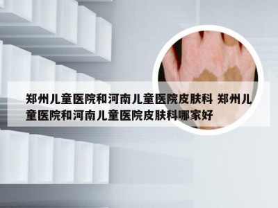 郑州儿童医院和河南儿童医院皮肤科 郑州儿童医院和河南儿童医院皮肤科哪家好